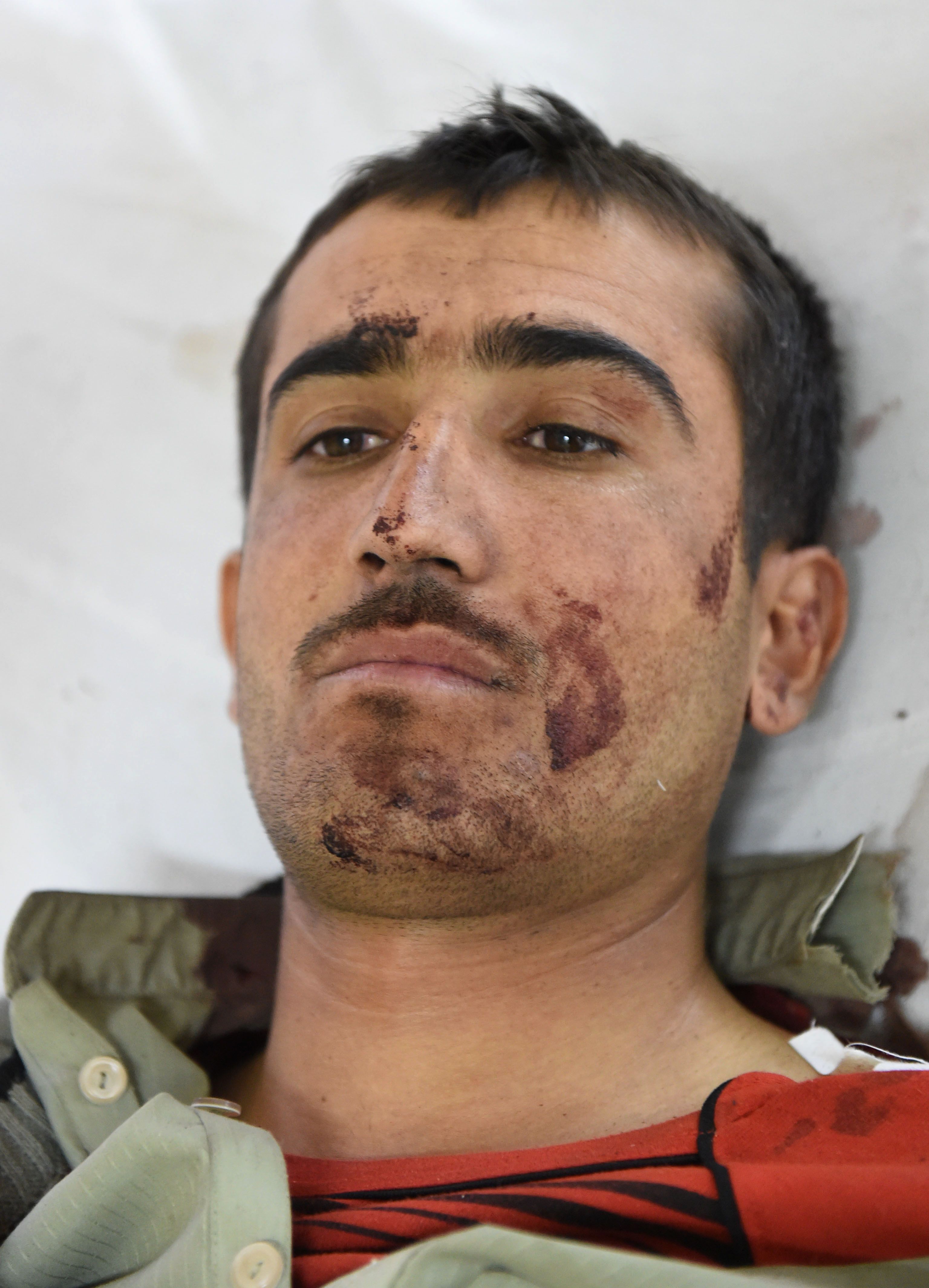 An injured policeman lies on a bed at a hospital in Quetta on October 25, 2016, after an overnight militant attack on the Police Training College Balochistan.