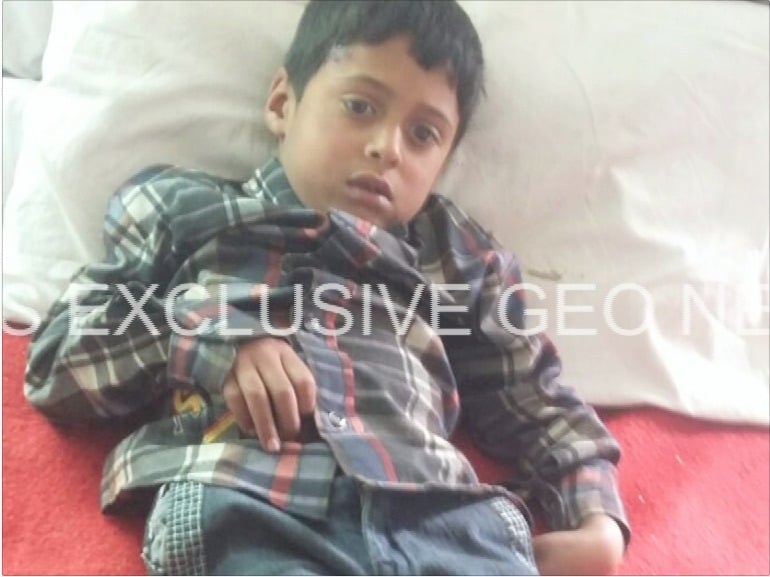   Picture of child injured from Indian shelling – Geo News 