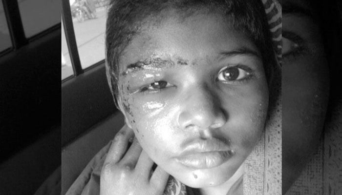 Torture marks found on child maid Tayyaba: Medical board