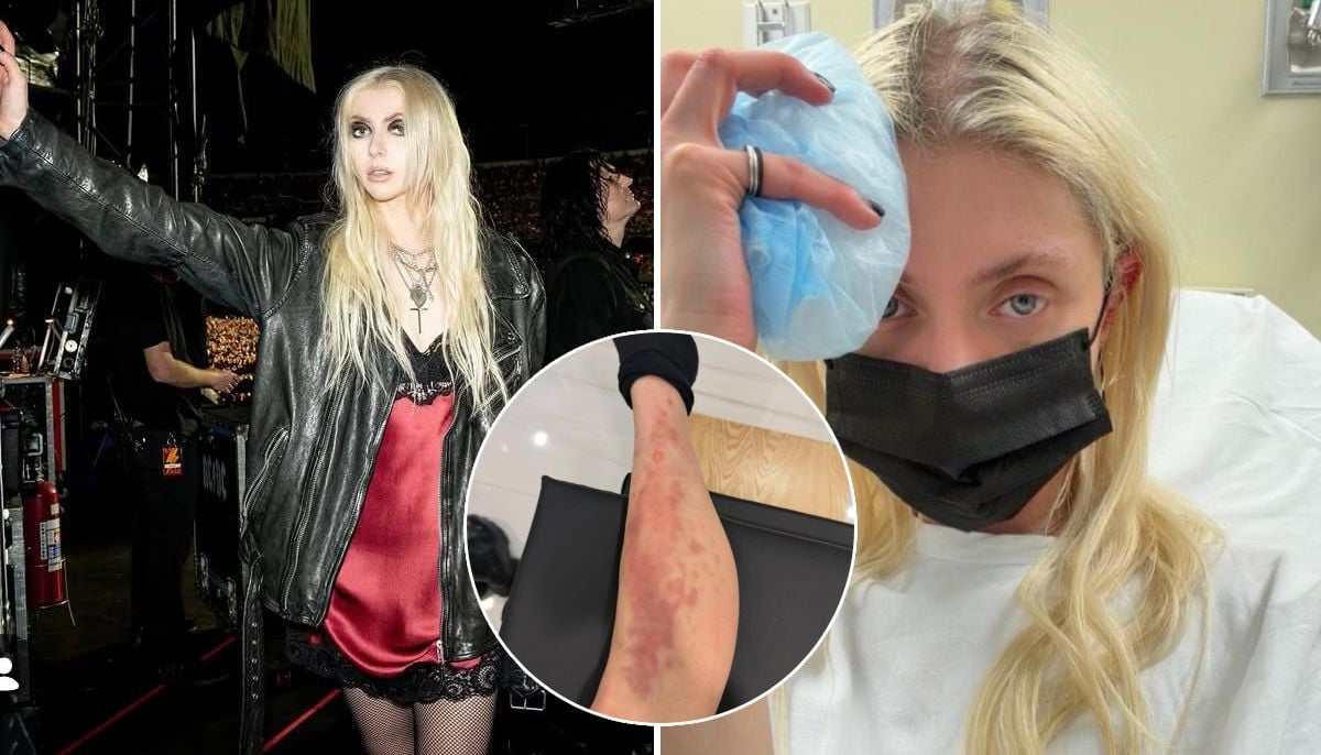 Taylor Momsen hospitalised week after getting bit by spider on AC/DC tour