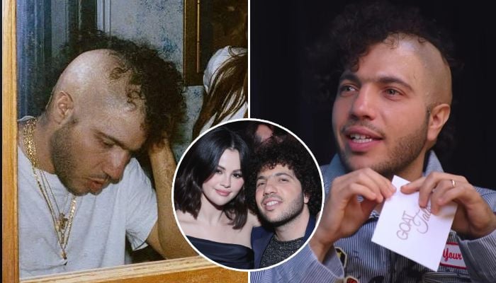 Did Benny Blanco really shave his head, or is it a bald cap?
