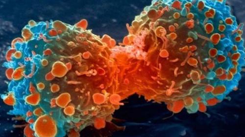 Cancer often due to bad luck, not genes or environment