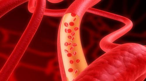 Nano-drones may knock cholesterol out of bloodstream: study