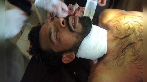 Pakistani injured by Indian cross-border firing dies at hospital