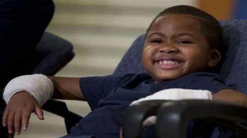 First child double hand transplant announced in US