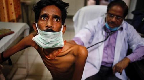 TB deaths ‘unacceptably high’ despite advances