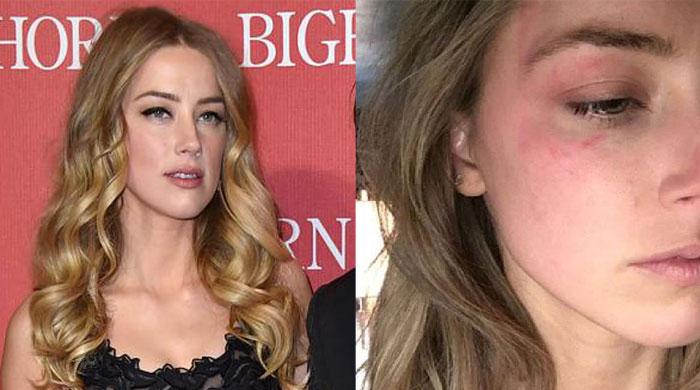 Amber Heard accuses estranged husband Johnny Depp of domestic violence