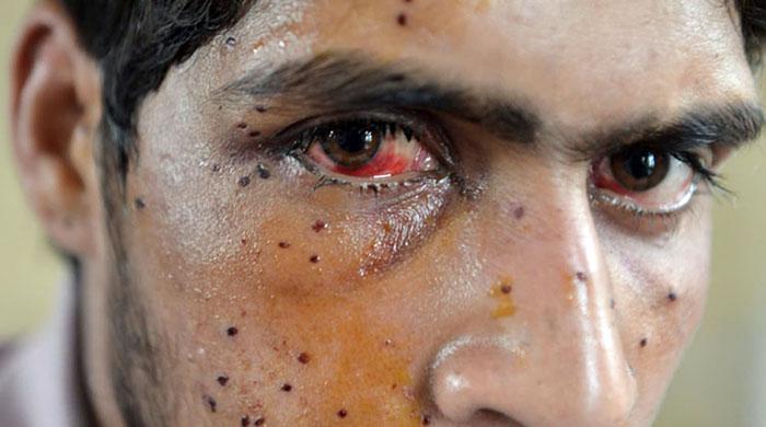Court refuses to ban pellet guns in Indian Occupied Kashmir