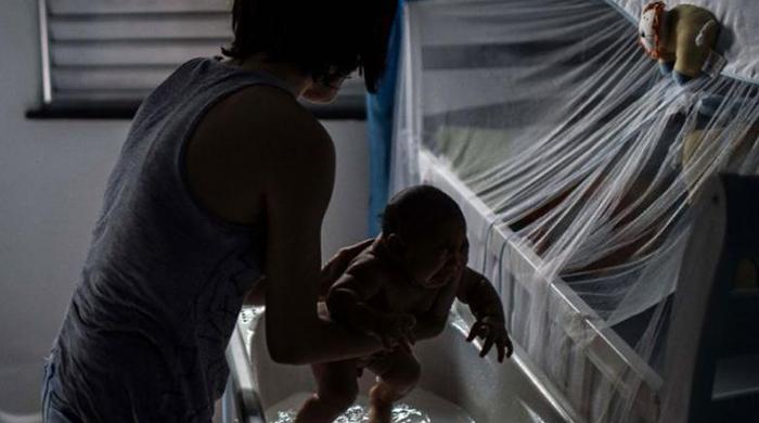 Thais probe babies with microcephaly for Zika link