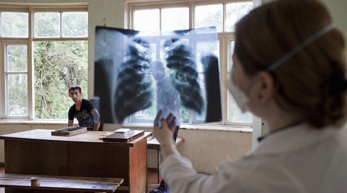 Efforts to beat tuberculosis fall far short, WHO warns