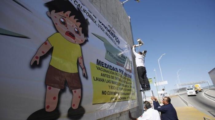 Fatal measles complication more common than thought: US study