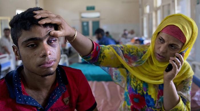 Kashmiri doctors suspect ‘something else’ in pellets