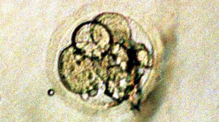 Scientific community debates research on 28-day embryos