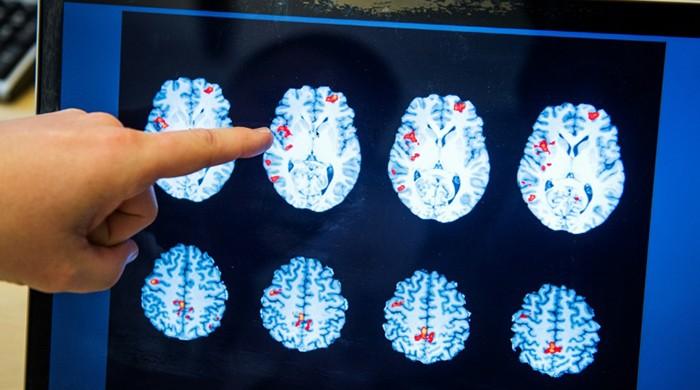 Human brain's face recognition develops into adulthood: studies