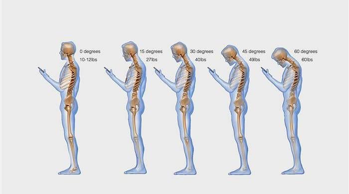 Text Neck: How smartphone usage is messing up our spine