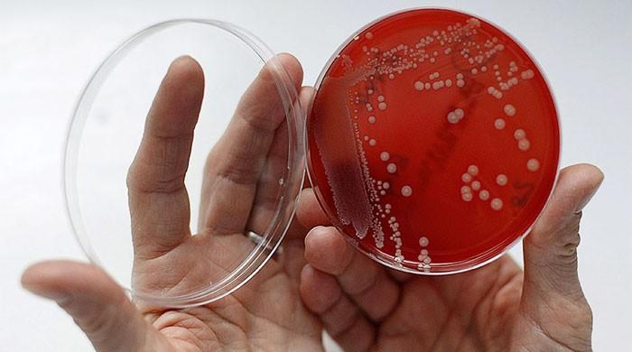 NASA sent a superbug to space: here's why