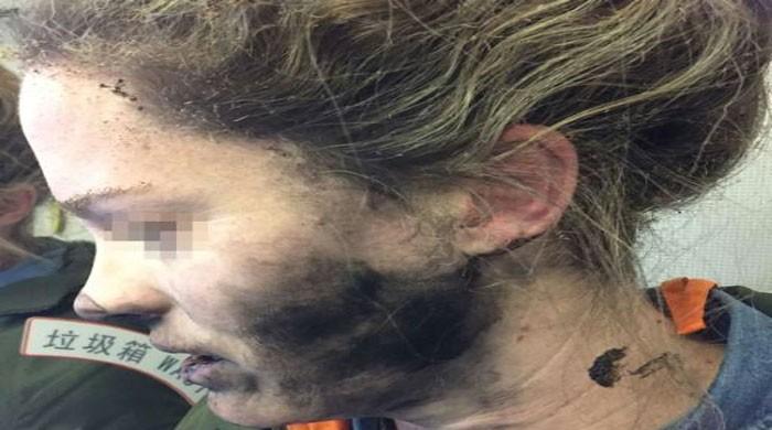 Headphone batteries explode on flight to Australia