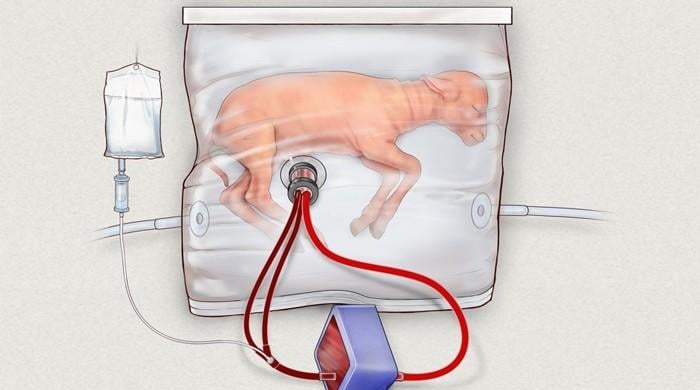 Scientists develop fluid-filled artificial womb to help premature babies