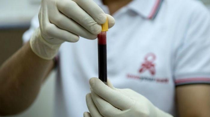 10-year lifespan gain for some HIV patients: study