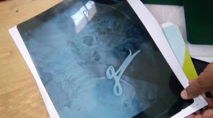 Botched operation: Scissor left inside stomach of 75-year-old woman