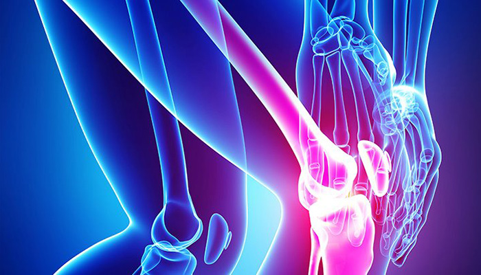 Osteoarthritis could be delayed by removing SnCs from joints