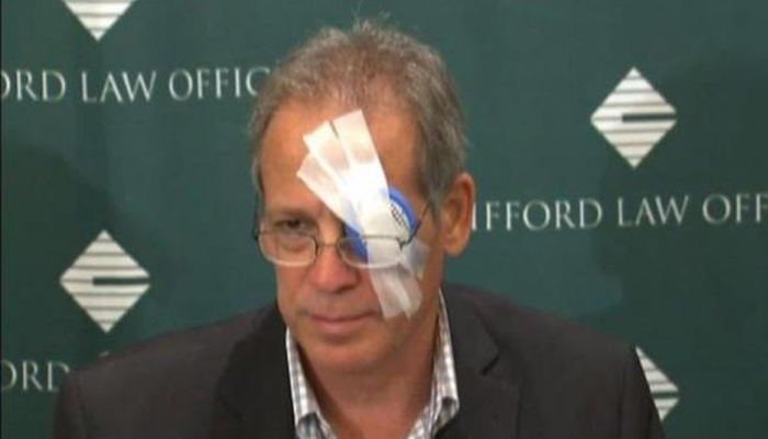 Chicago man blinded in one eye by baseball sues the sport