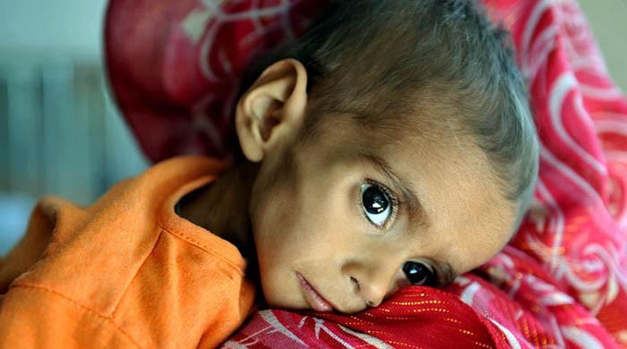 Starved for attention