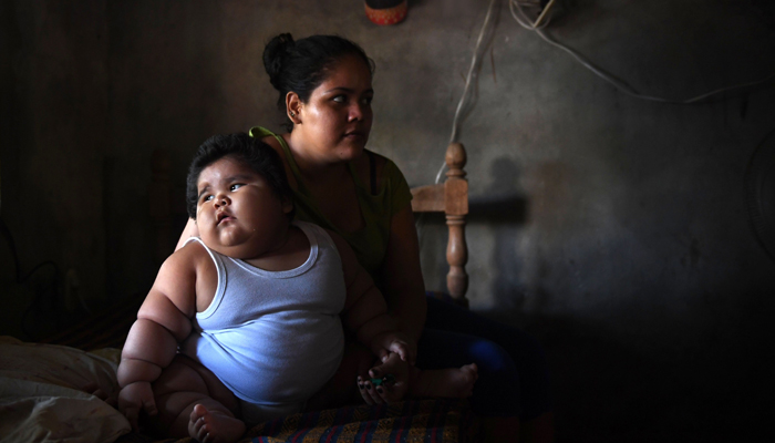 Mexican toddler weighing 28 kilos baffles doctors