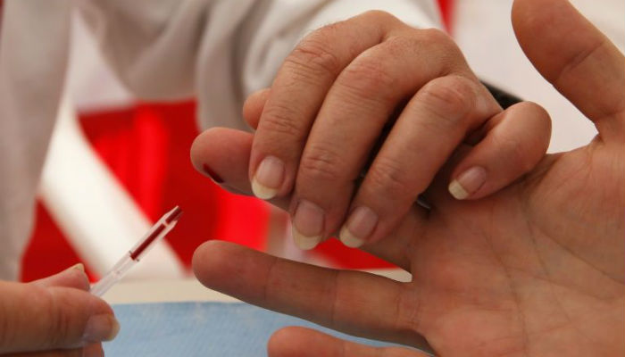 Men at higher risk of dying of AIDS than women: UNAIDS