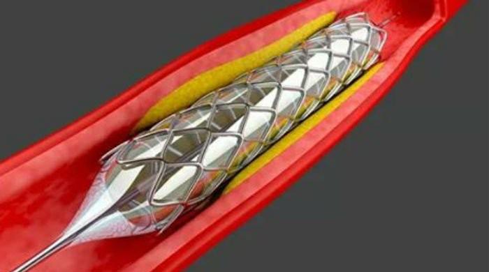 Medical profession not aimed at profiteering, observes SC in stents case