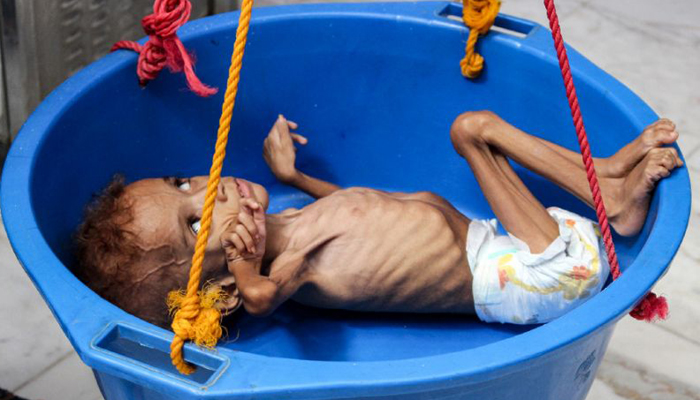 Yemen faces worsening threat of famine: UN aid chief