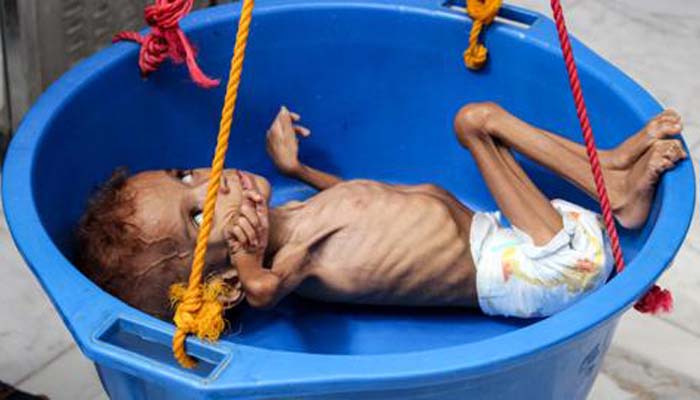 14 million 'on brink of famine' in Yemen: charities