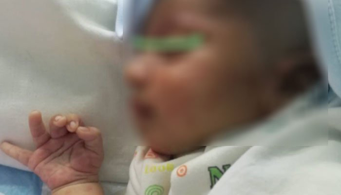 Infant undergoes successful bone marrow transplant at NIBD