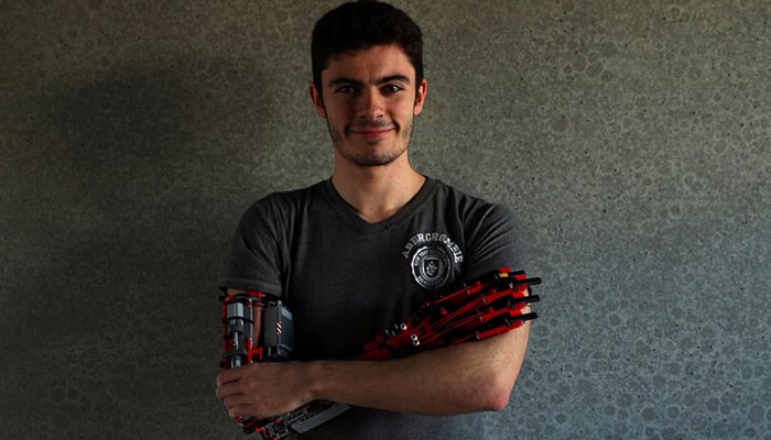 Brick by Lego brick, teen builds his own prosthetic arm