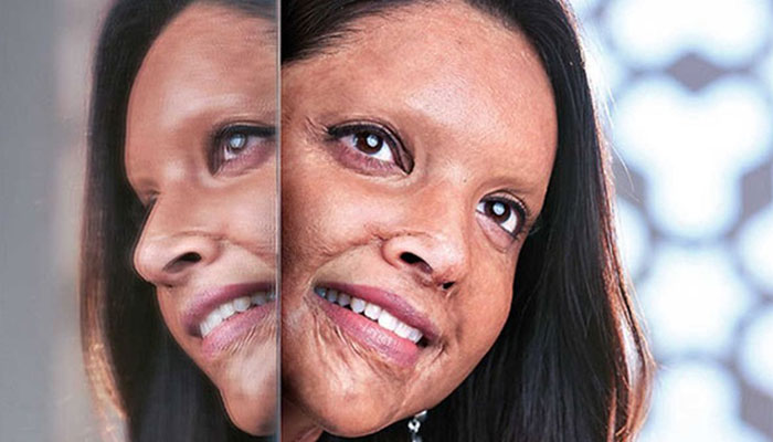 Deepika Padukone shares first look as acid attack survivor in ‘Chhapaak’