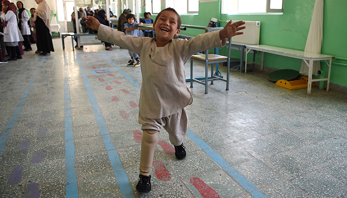 Young Afghan Amputee's Joy at New Leg Goes Viral