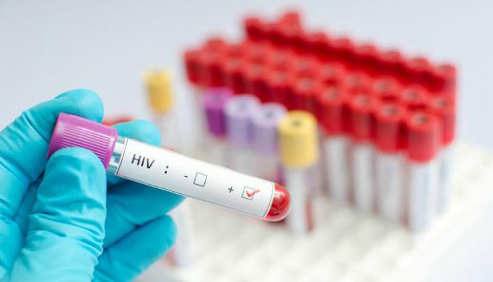 Larkana’s Ratodero HIV report reveals startling facts