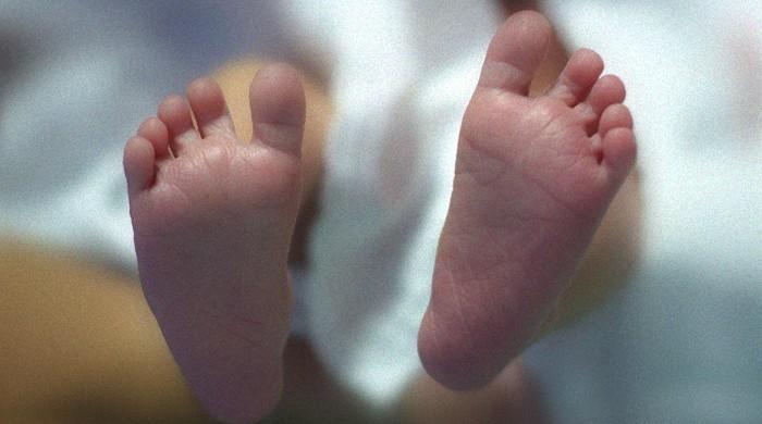 Baby born with two heads in Mirpurkhas shifted to Karachi over health concerns