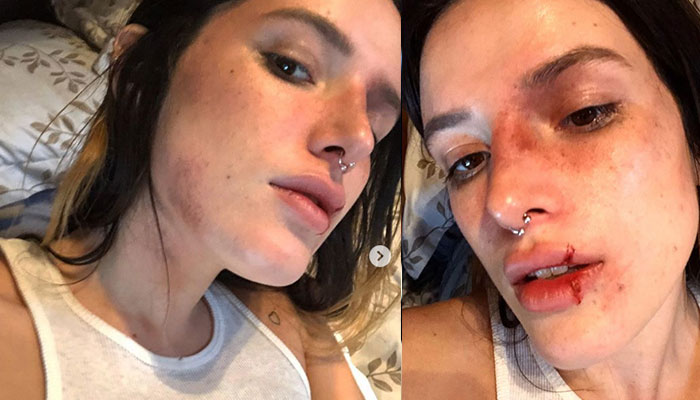 Bella Thorne slammed over her Halloween look 'glorifying physical abuse'