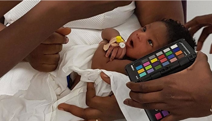 App that detects jaundice in newborns could save hundreds of thousands of lives in Asia and Africa