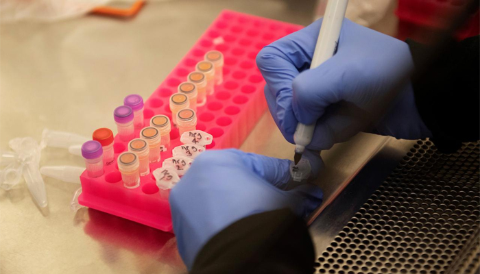 FDA warns against using hydroxychloroquine for coronavirus