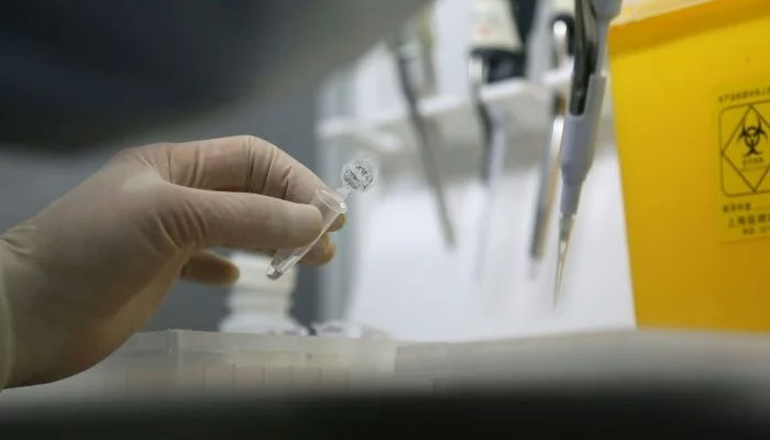 Pakistan obtains rapid test kits that can detect coronavirus within 20 minutes