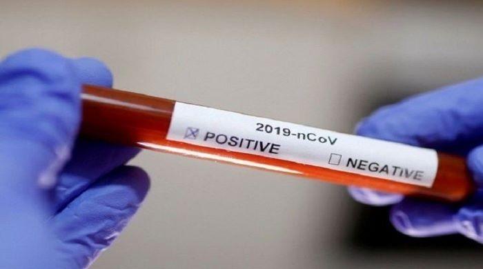 Is coronavirus testing cheaper in Pakistan than other countries? Is coronavirus testing cheaper in Pakistan than other countries?