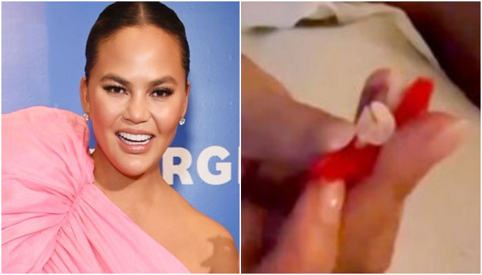 Chrissy Teigen leaves netizens in stitches after she loses tooth while eating candy