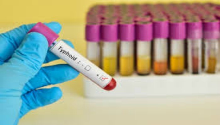 Pakistan becomes first country in region to to roll out typhoid vaccine - Vimarsana News
