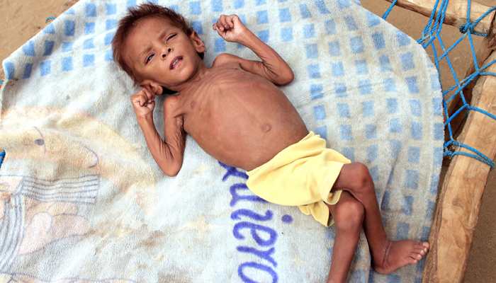 Yemen 'step away' from devastating famine: UN