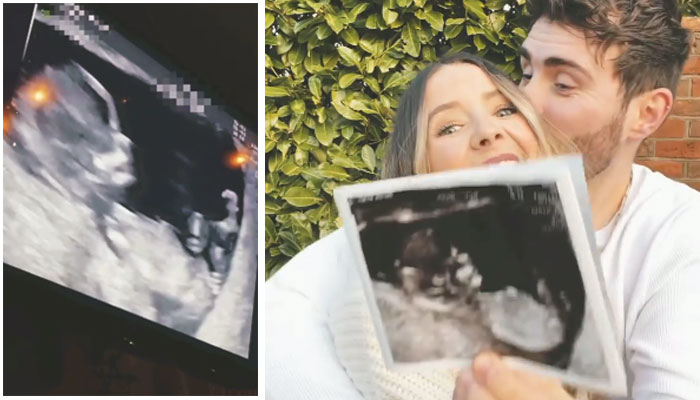 YouTuber Zoe Sugg announces pregnancy news with boyfriend Alife Dayes