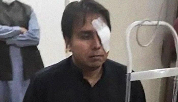 Shahbaz Gill's left eye infected due to ink thrown by PML-N workers, say doctors