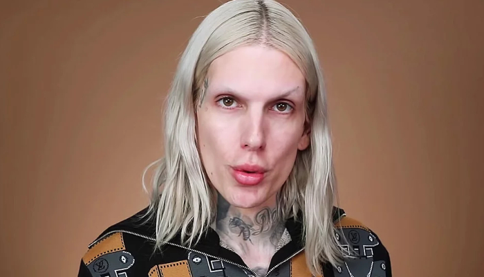 Jeffree Star says he is in ‘excruciating pain’ as he updates fans after car accident 