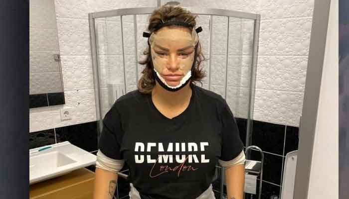 Katie Price reveals she was seeing death on the operating table during cosmetic surgery